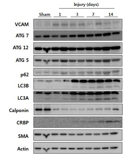 SD Rat의 경동맥에 Injury를 유발하여 혈관평활근세포 의 탈분화를 유도한 후 탈분화 maker인 SMA, CRBP, Calponin 과 Autophagy 관련 유전자인 ATG 5, 7, 12와 p62, LC3A/B를 계열 유전자를 시간대별 western blot을 통하여 확인함.