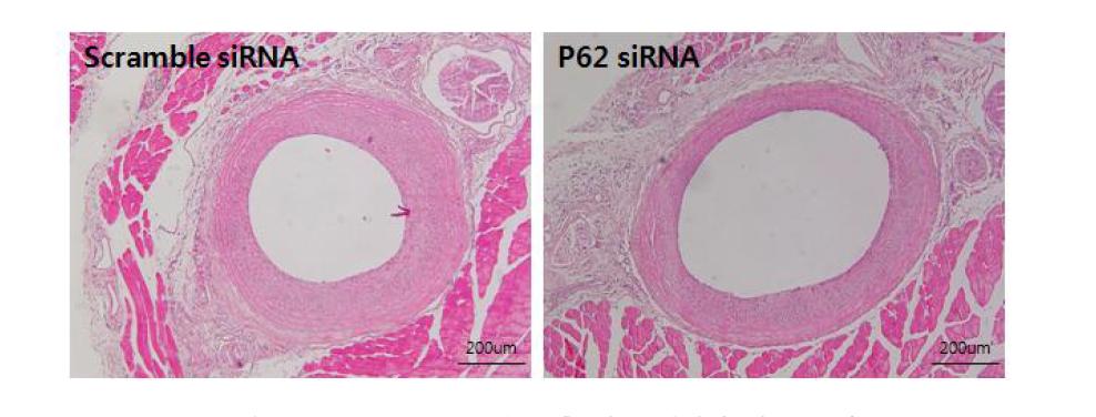p62siRNA 전달 후 혈관 재협착 여부 분석