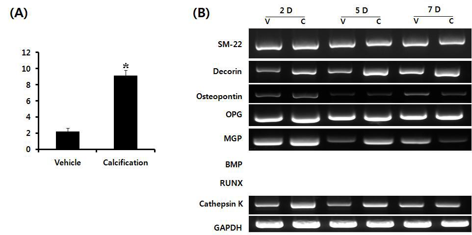 calcification 유도 배양 조건에서 7일째에 세포내 칼슘 침착이 증가함 (A), calcification 유도 배양 조건에서 혈관 석회화와 혈관 탈분화와 관련된 유전자 RT-PCR을 이용한 분석 결과 (B)
