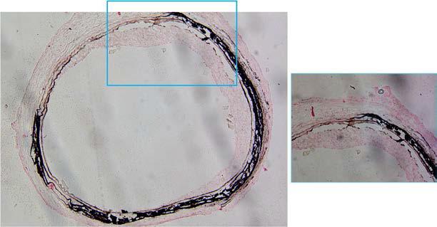 그림 4-28에서 사용한 동일한 조직 슬라이드를 silver stain 후 현미경하에서 촬영한 사진. 왼쪽 : 저배율, 오른 쪽 : 고배율