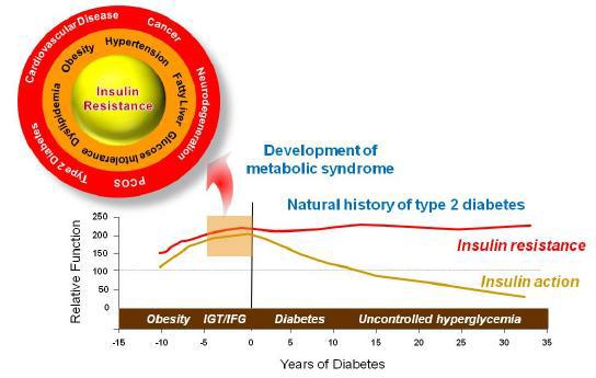 제2형 당뇨병과 대사증후군의 원인으로 작용하는 인슐린 저항성