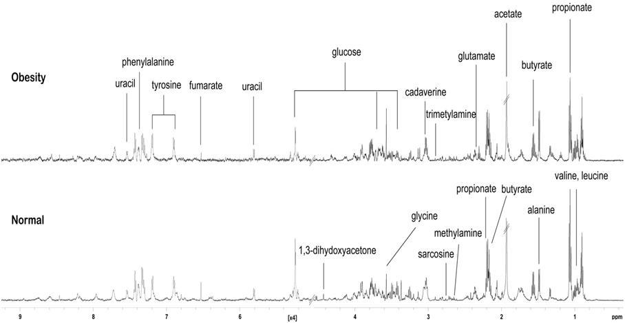 비만과 정상체중 청소년의 NMR spectrum
