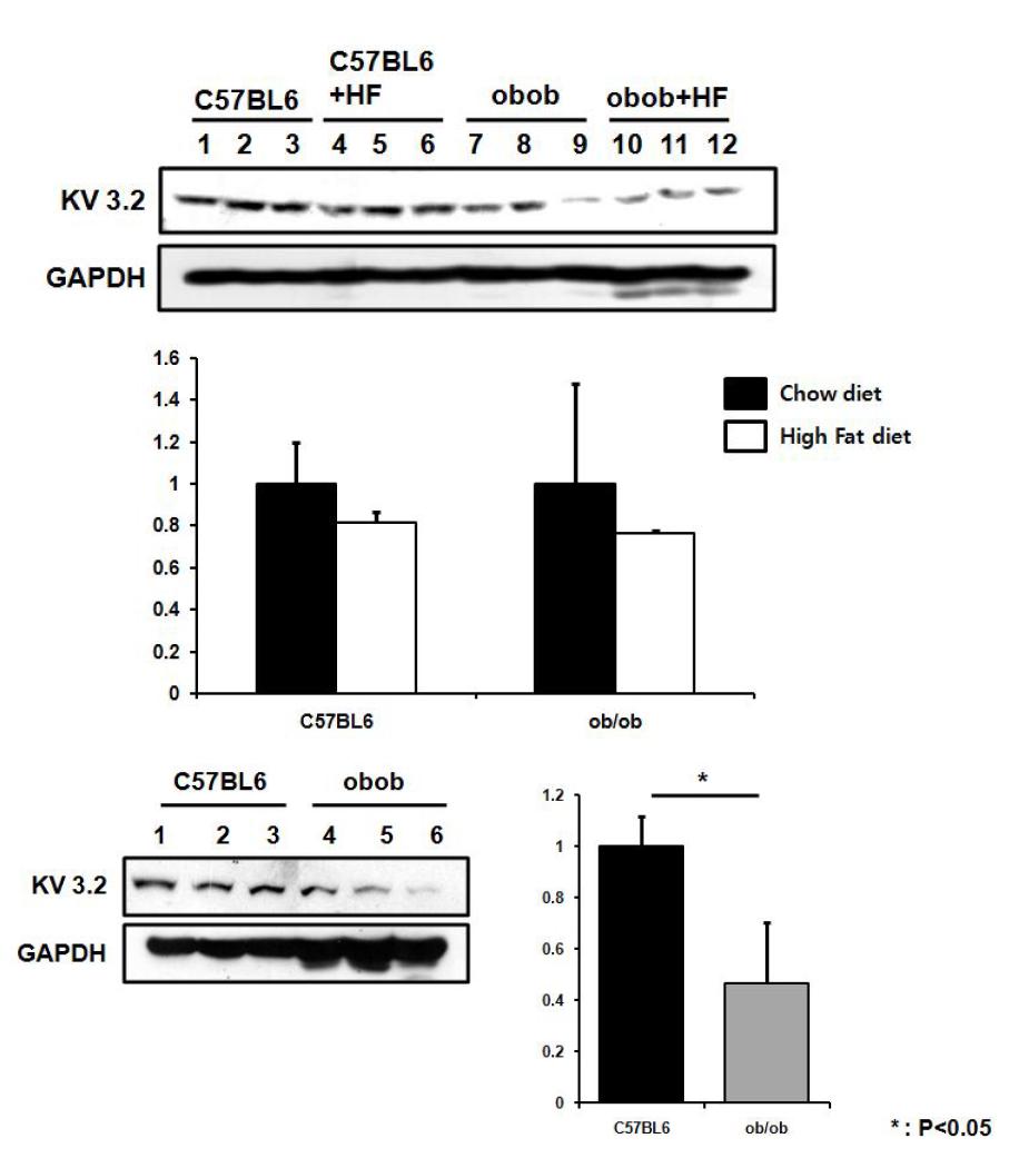 식이 변화에 따른 C57BL6와 ob/ob mice에서의 KCNC2 발현 변화