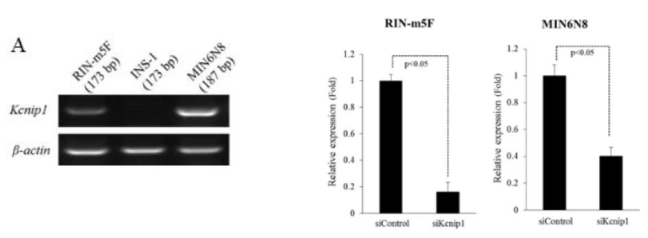 세포주에서의 KCNIP1 유전자발현과 siRNA를 이용한 유전자발현 감소