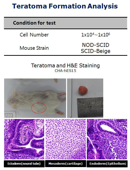 CHA-hES15를 이용한 기형종 형성