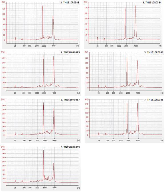 Bioanalyzer QC_28s/18s ratio 결과값 (CRMiPS-GFP, hFmiPS2, hUSiPS2-4)