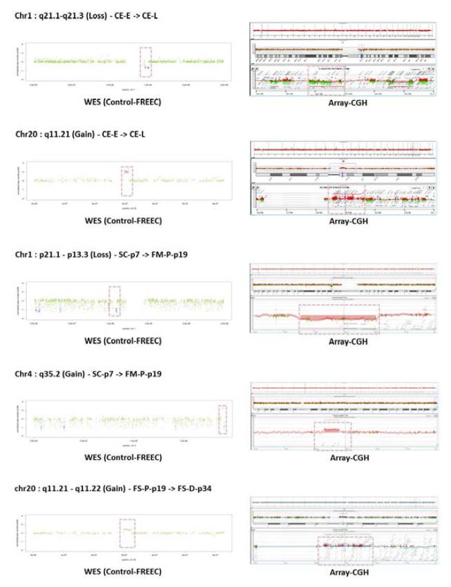 WES와 aCGH의 CNV 결과 확인