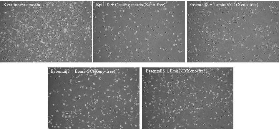 재조합 세포외기질에서 xeno-free 배양액(E8)을 이용하여 배양한 소변유래세포