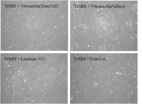 다양한 재조합 세포외기질에서 xeno-free 배양액(TeSR-E8)을 이용하여 배양한 배아줄기세포(SNUhES31)의 colony 모양