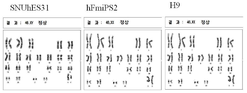 Xeno-free 조건에서 장기 배양한 줄기세포의 염색체 이상 검사(karyotyping)