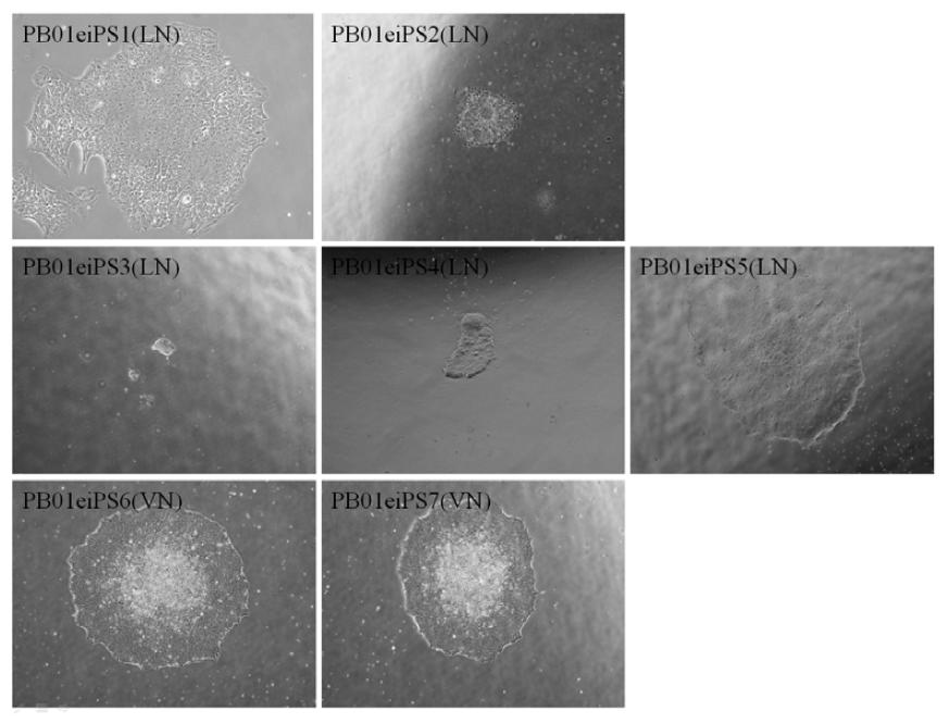PBMC로부터 episomal vector를 이용하여 xeno-free 조건에서 수립한 역분화줄기세포주. LN: laminin-521; VN: vitronectin.