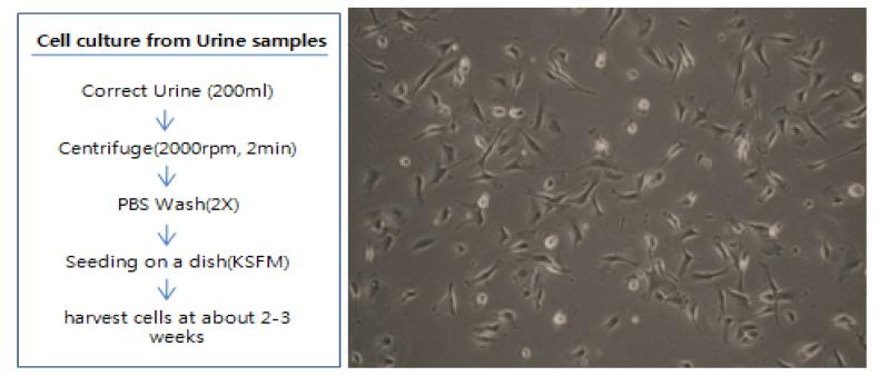사람 소변으로부터 유래한 초대배양세포 획득방법(왼쪽)과 소변 유래 세포(오른쪽)