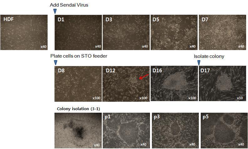 사람의 dermal fibroblast에 Sendai virus 도입을 통해 수립한 역분화줄기세포 제작 과정