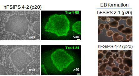 사람의 dermal fibroblast에 Sendai virus 도입을 통해 수립한 역분화줄기세포 colony들의 줄기세포 마커의 발현 확인과(왼쪽) in vitro differenciation 유도에 의한 Embryonic body 형성 확인