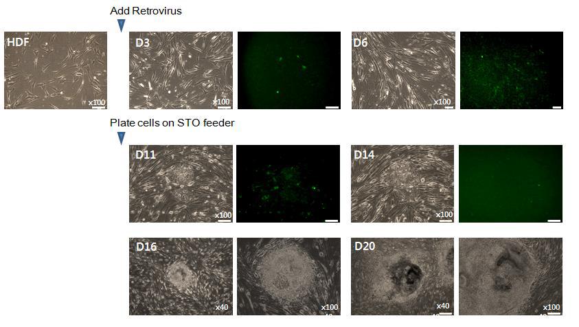 사람의 dermal fibroblast에 Retrovirus 도입을 통해 수립한 역분화줄기세포 제작 과정