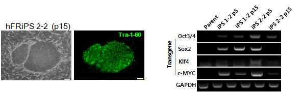 사람의 dermal fibroblast에 Retrovirus를 도입을 통해 수립한 역분화줄기세포colony의 줄기세포 마커의 발현 확인과(왼쪽) exogene들의 silencing 확인