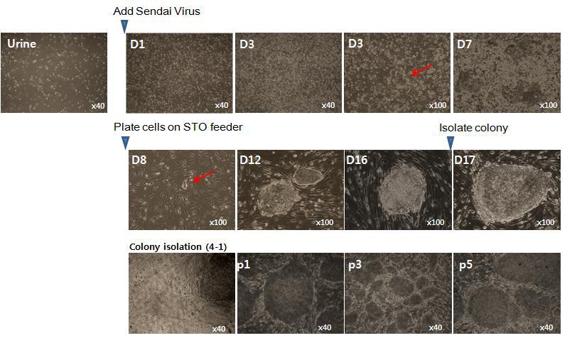 사람의 소변 유래 세포에 Sendai virus 도입을 통해 수립한 역분화줄기세포 제작 과정