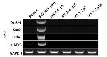 Sendai virus로 수립한 역분화줄기세포에서 exogene의 silencing 확인