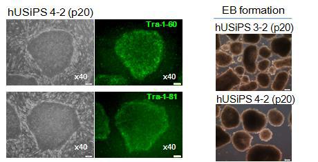 사람의 소변 유래 세포에 Sendai virus 도입을 통해 수립한 역분화줄기세포 colony 들의 줄기세포 마커의 발현 확인과(왼쪽) in vitro differenciation 유도에 의한 Embryonic body 형성