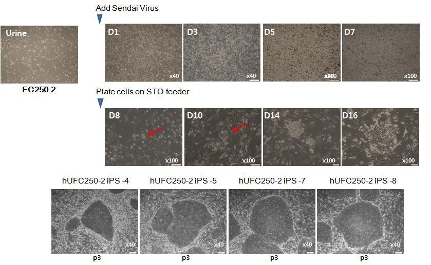 CMT 질환자 (FC250-2) 소변 유래 세포에 Sendai virus 도입을 통해 수립한 역분화줄기세포 제작 과정