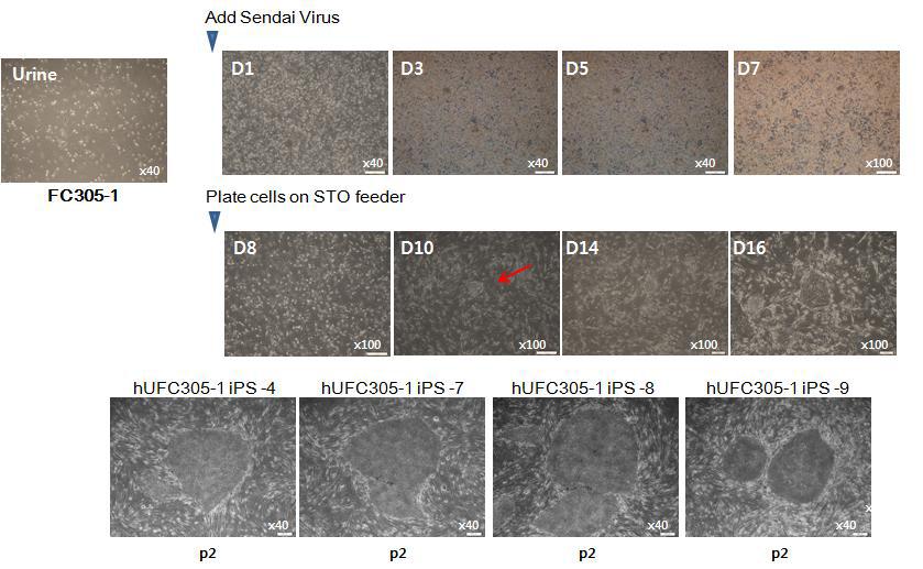 CMT 질환자 (FC305-1) 소변 유래 세포에 Sendai virus 도입을 통해 수립한 역분화줄기세포 제작 과정