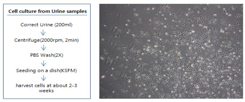 ALS 질환자#1 소변으로부터 유래한 초대배양세포 획득방법(왼쪽)과 소변 유래 세포(오른쪽)