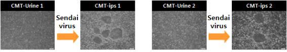 CMT 질환자 소변세포 유래 역분화줄기세포, CMT type1 또는 type 2 질환자 소변세포(CMT-Urine1,2)로부터의 제작된 역분화줄기세포(CMR-ips1,2)