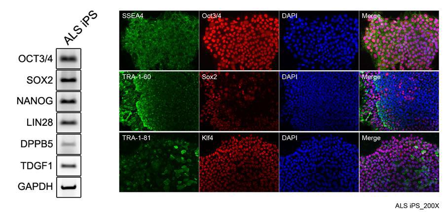 제작된 ALS 질환자 역분화줄기세포의 기초특성분석