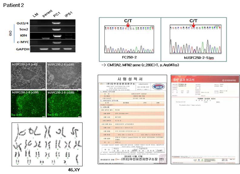 제작한 CMT2 환자(Patient2)의 소변세포 유래 역분화줄기세포주의 기본 특성 분석