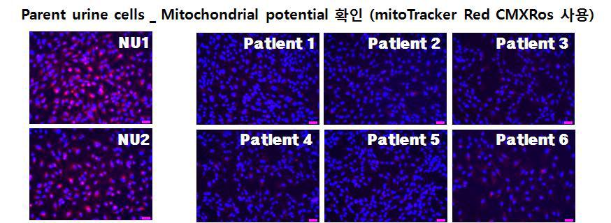 mitoTracker를 이용하여 환자 초대배양세포의 Mitochondrial potential 확인