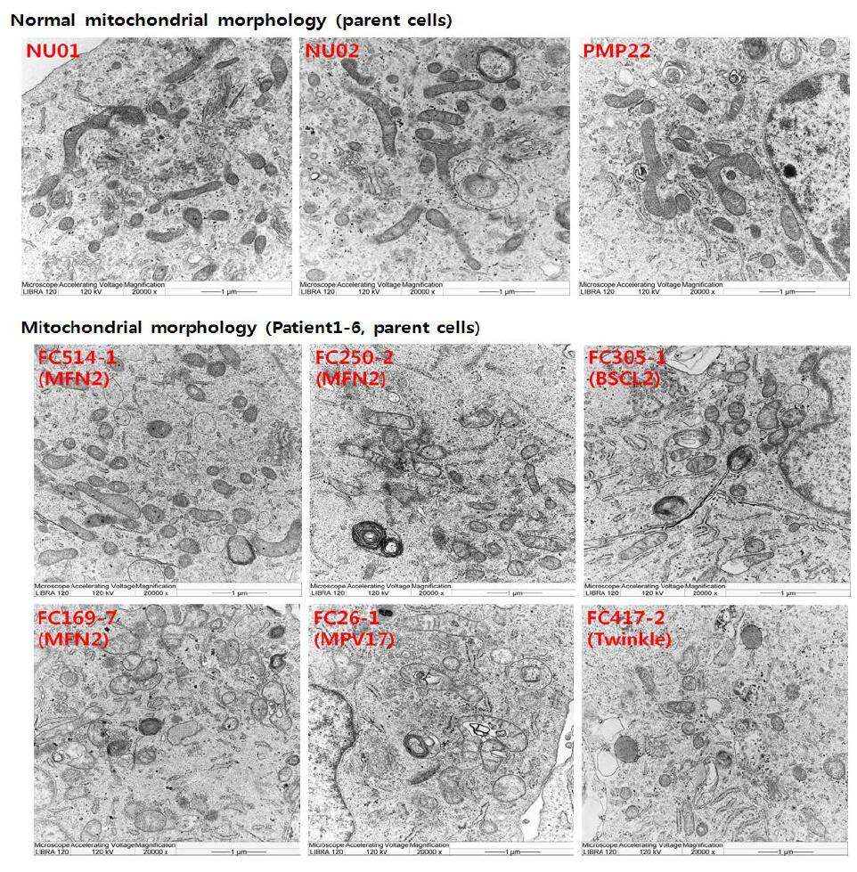 투과전자현미경(Transmission electron microscope)을 이용하여 환자 초대 배양세포의 Mitochondrial morphology 확인(NU01, Control1; Nu02, Control2, PMP22, Control3; FC514-1, Patient1; FC250-2, Patient2; FC305-1, Patient3, FC169-7, Patient4; FC26-1, Patient5; FC417-2, Patient6)