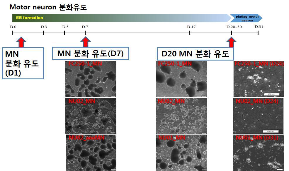 CMT2 환자 및 정상 역분화줄기세포로부터의 운동신경세포 분화 유도