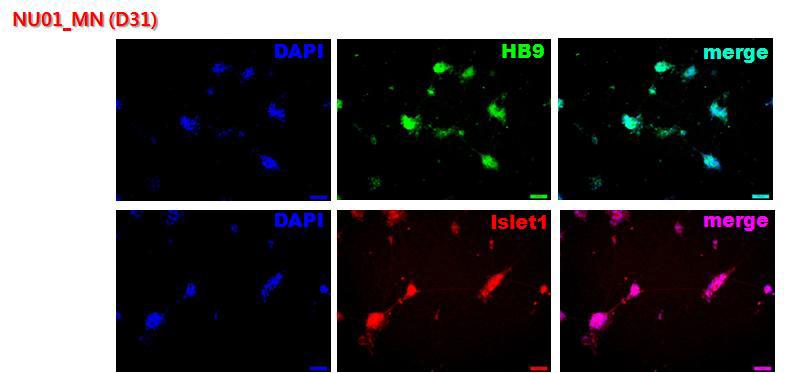 정상 역분화줄기세포(hUS01ips2-4)로부터의 운동신경분화 유도후 neuronal marker인 HB9과 islet1의 면역화학염색법 확인