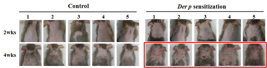 Der p 감작에 따른 Nc/Nga 마우스에서의 아토피피부염 발생