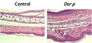 Der p 감작에 따른 Nc/Nga 마우스에서의 피부조직 변화