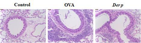 천식 마우스모델의 폐조직에서의 면역·염증세포 유입 분석