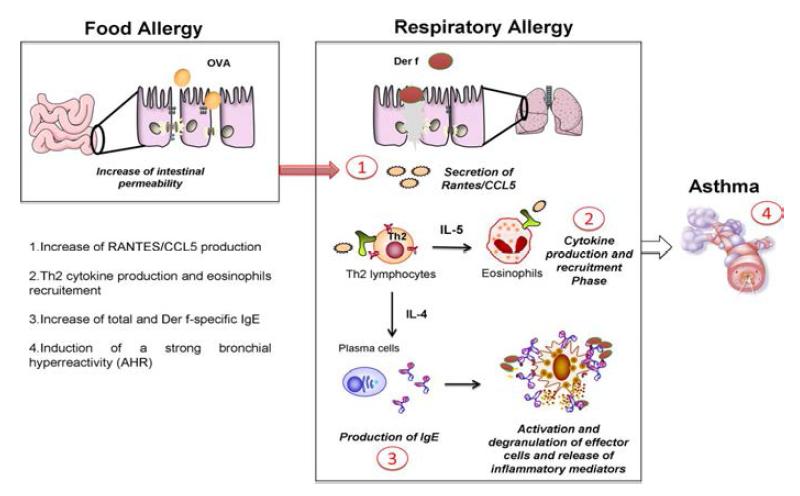 Th2 세포에 의한 천식 발생