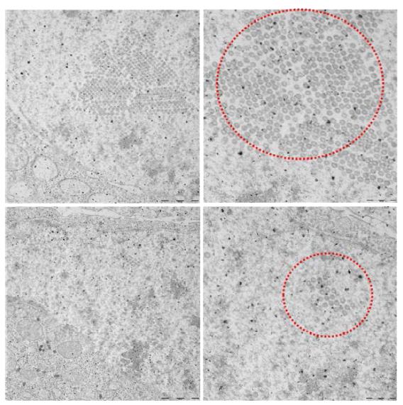 전자현미경을 통한 DVLP(1-4) 생성 확인, 생성 된 Stable cell을 배양하여 전자현미경(Electron microscopy, EM)으로 DVLP(1-4)(diameter 35~45nm) 생성을 확인