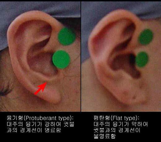 대주 형태 분류기준 및 참고 그림