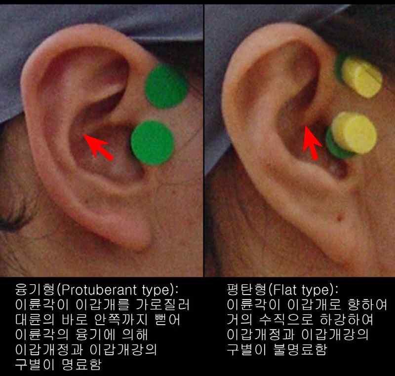 이륜각 형태 분류기준 및 참고 그림