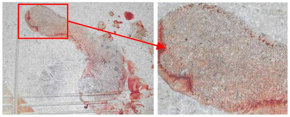 범죄현장의 맨발 혈흔족적으로서 발바닥 족장문이 관찰된다