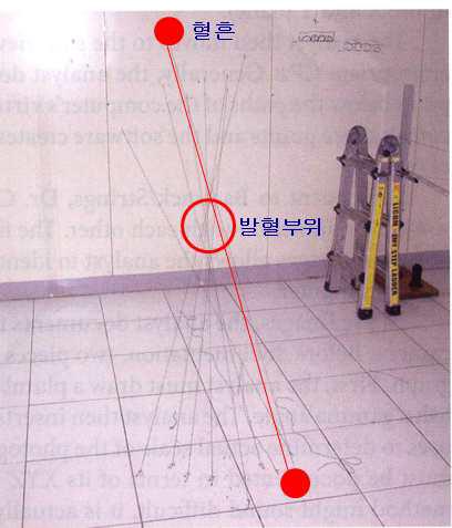 줄연결기법을 시행한 상태