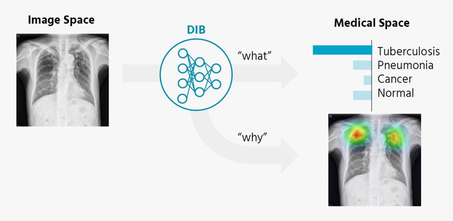 Data-driven Imaging Biomarker (DIB) 개념도