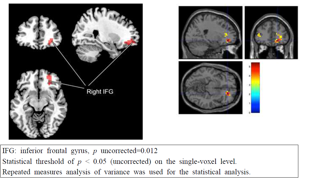 fMRI 결과 분석