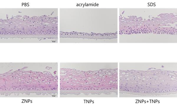 KeraSkinTM processed for paraffin sections and stained with H & E stain for histological examination.