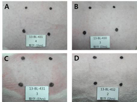 Corrosion and irritation test using rabbit skin in the in vivo test.