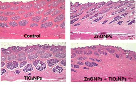 Histopathology of rabbit skin obtained in the in vivo test.