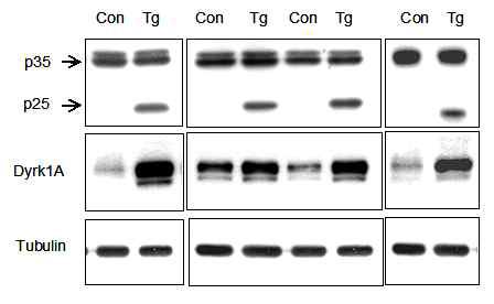 P25 형질전환 생쥐에서 Dyrk1A 단백질의 발현 증가
