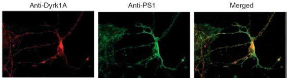 rat primary cortical neuronal cells에서 Dyrk1A와 PS1의 부분적 co-localization