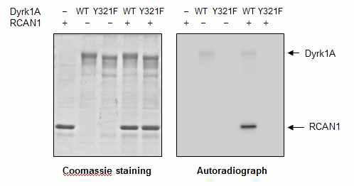왼쪽 그림, 분리한 His-RCAN1과 Dyrk1A 단백질의 Coomassie staining 오른쪽 그림, Dyrk1A 또는 Dyrk1A 불활성화 mutant (Y321F)에 의한 RCAN1의 인산화를 보여주는 autoradiography